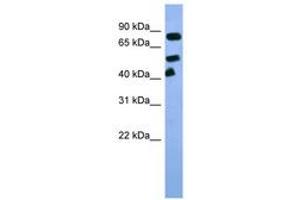Image no. 1 for anti-Aryl Hydrocarbon Receptor Nuclear Translocator (ARNT) (C-Term) antibody (ABIN6746022) (ARNT 抗体  (C-Term))