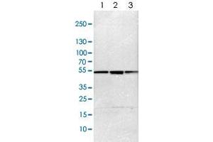 Western blot analysis of Lane 1: NIH-3T3 cell lysate (Mouse embryonic fibroblast cells), Lane 2: NBT-II cell lysate (Rat Wistar bladder tumour cells), Lane 3: PC12 cell lysate (Pheochromocytoma of rat adrenal medulla) with PSMC4 polyclonal antibody  at 1:100-1:500 dilution. (PSMC4 抗体)