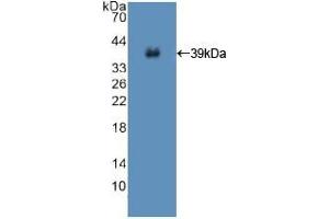 Western blot analysis of recombinant Human ISR. (Insulin Receptor 抗体  (AA 1027-1364))