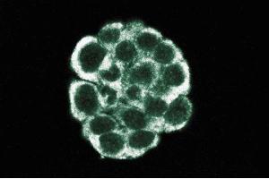 Immunofluorescent staining of WIDR cells. (Dynamitin 抗体  (AA 55-196))