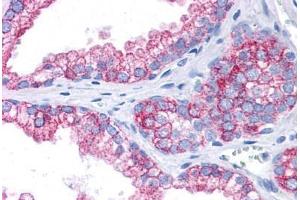 Human Prostate: Formalin-Fixed, Paraffin-Embedded (FFPE) (EPB41L2 抗体  (AA 481-530))