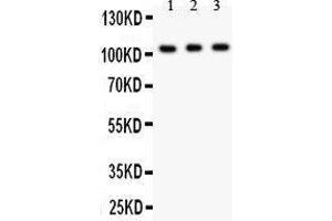 Anti- GRIK1 antibody, Western blotting All lanes: Anti GRIK1  at 0. (GRIK1 抗体  (AA 271-450))