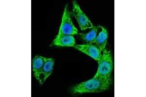 Immunofluorescence analysis of HepG2 cells using DCX antibody (green). (Doublecortin 抗体  (AA 362-411))