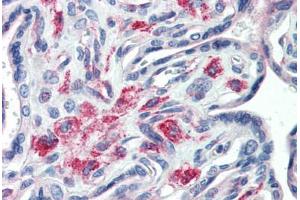 Human Placenta (formalin-fixed, paraffin-embedded) stained with STX12 antibody ABIN364383 at 20 ug/ml followed by biotinylated anti-mouse IgG secondary antibody ABIN481714, alkaline phosphatase-streptavidin and chromogen. (Syntaxin 12 抗体  (Cytoplasmic Domain))