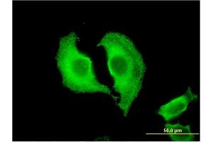 Immunofluorescence of monoclonal antibody to CTRB1 on HeLa cell. (CTRB1 抗体  (AA 101-200))