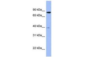 Image no. 1 for anti-Radixin (RDX) (AA 467-516) antibody (ABIN6741663) (Radixin 抗体  (AA 467-516))