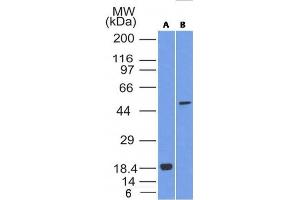 Western Blot Analysis of SOX10 (A) Recombinant protein; (B) A375 cell lysate using SOX10 Mouse Monoclonal Antibody (SOX10/1074). (SOX10 抗体  (AA 115-269))