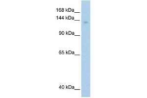 WB Suggested Anti-MOV10 Antibody Titration:  1. (MOV10 抗体  (C-Term))