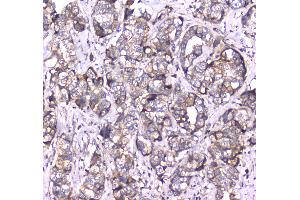 IHC analysis of RAB27A using anti-RAB27A antibody . (RAB27A 抗体  (AA 98-216))