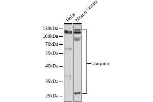 Western blot analysis of extracts of various cell lines, using Ubiquitin pAb  at 1:3000 dilution. (Ubiquitin B 抗体)