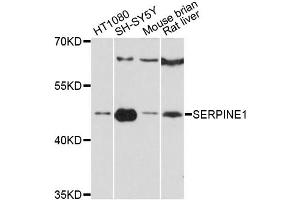 Western blot analysis of extracts of various cell lines, using SERPINE1 antibody (ABIN5998780) at 1:3000 dilution. (PAI1 抗体)
