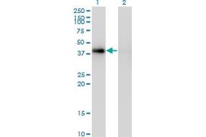 Western Blot analysis of PCYT1A expression in transfected 293T cell line by PCYT1A monoclonal antibody (M03), clone 7H8. (PCYT1A 抗体  (AA 2-90))