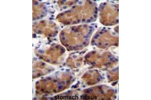 Immunohistochemistry (IHC) image for anti-Leucine-Rich Repeat and WD Repeat-Containing Protein 1 (LRWD1) antibody (ABIN2996388) (LRWD1 抗体)