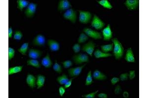 Immunofluorescence staining of Hela cells with ABIN7163757 at 1:100, counter-stained with DAPI. (PARP8 抗体  (AA 628-854))