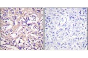 Immunohistochemistry (IHC) image for anti-Thymidine Kinase 1, Soluble (TK1) (AA 1-50) antibody (ABIN2888706) (TK1 抗体  (AA 1-50))