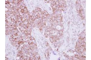 anti-Transforming Growth Factor beta Regulator 4 (TBRG4) (AA 1-328) antibody