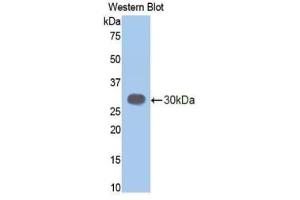 Detection of Recombinant ELA3B, Mouse using Polyclonal Antibody to Elastase 3B (ELA3B) (Elastase 3B 抗体  (AA 28-267))