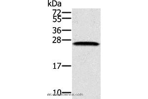 Western blot analysis of K562 cell, using SSX1 Polyclonal Antibody at dilution of 1:400 (SSX1 抗体)