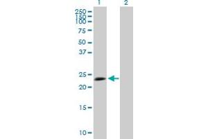 Western Blot analysis of TPD52L1 expression in transfected 293T cell line by TPD52L1 MaxPab polyclonal antibody. (TPD52L1 抗体  (AA 1-204))