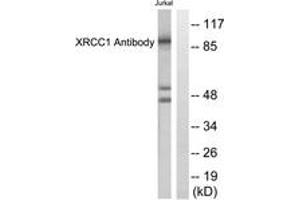 Western blot analysis of extracts from Jurkat cells, using XRCC1 Antibody. (RCC1 抗体  (AA 517-566))