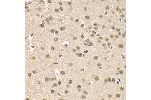 Immunohistochemistry of paraffin-embedded mouse brain using CSNK1E Antibody. (CK1 epsilon 抗体)