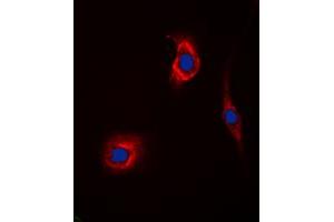 Immunofluorescent analysis of GAK staining in Hela cells. (GAK 抗体  (N-Term))