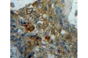 IHC-P analysis of Lung tissue, with DAB staining. (ECE1 抗体  (AA 214-448))