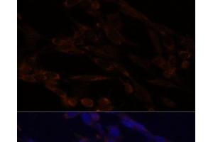 Immunofluorescence analysis of NIH/3T3 cells using IKK alpha Polyclonal Antibody at dilution of 1:100. (IKK alpha 抗体)
