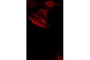 ABIN6276512 staining  HeLa cells by IF/ICC. (SMAD1 抗体  (Internal Region))