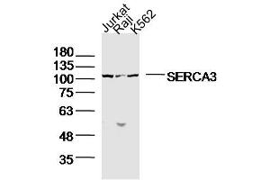 Lane1: jurkat Lane 2: raji Lane 3: K562 lysates probed with SERCA3 Polyclonal Antibody, Unconjugated  at 1:300 dilution and 4˚C overnight incubation. (ATP2A3 抗体  (AA 101-200))