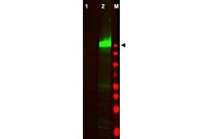 Image no. 2 for anti-Epidermal Growth Factor Receptor (EGFR) (AA 1189-1199), (pTyr1197) antibody (ABIN401341) (EGFR 抗体  (pTyr1197))