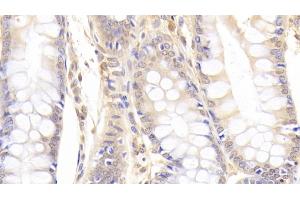 Immunohistochemistry (IHC) image for anti-Peptidyl Arginine Deiminase, Type II (PADI2) antibody (ABIN7441295)