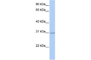WB Suggested Anti-HOXC11 Antibody Titration:  0. (HOXC11 抗体  (Middle Region))