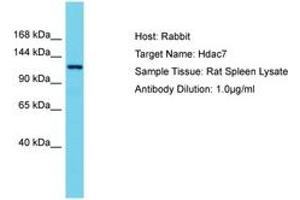 Image no. 1 for anti-Histone Deacetylase 7 (HDAC7) (AA 57-106) antibody (ABIN6750273) (HDAC7 抗体  (AA 57-106))