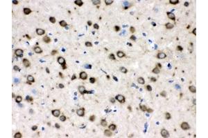 Immunohistochemistry (IHC) image for anti-Chaperonin Containing TCP1, Subunit 4 (Delta) (CCT4) antibody (ABIN4952801)