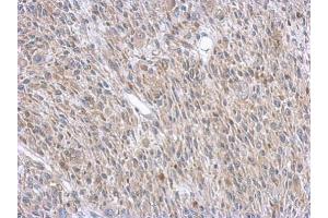 Immunohistochemistry (IHC) image for anti-Argininosuccinate Lyase (ASL) antibody (ABIN2856924)
