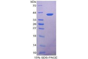 SDS-PAGE (SDS) image for Keratin 14 (KRT14) (AA 122-429) protein (His tag) (ABIN2125548) (KRT14 Protein (AA 122-429) (His tag))