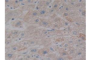 Immunohistochemistry (IHC) image for anti-Nitric Oxide Synthase 2, Inducible (NOS2) (AA 533-696) antibody (ABIN7432712)
