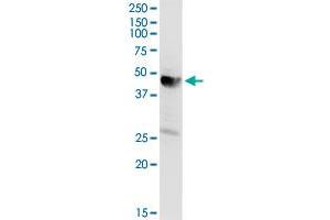 AACS MaxPab rabbit polyclonal antibody. (AACS 抗体  (AA 1-410))