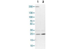 Western Blot analysis of Lane 1: NIH-3T3 cell lysate (mouse embryonic fibroblast cells) and Lane 2: NBT-II cell lysate (Wistar rat bladder tumour cells) with VPS28 polyclonal antibody . (VPS28 抗体)