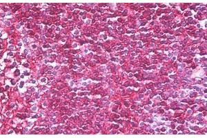 Anti-CD45RB antibody IHC staining of human tonsil. (CD45RB 抗体  (AA 79-88))