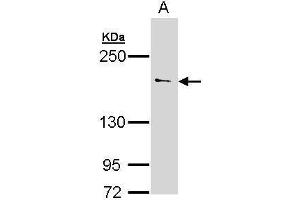 WB Image Sample (30 ug of whole cell lysate) A: 293T 5% SDS PAGE antibody diluted at 1:500 (UNC13B 抗体  (Internal Region))