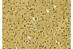 ABIN6275631 at 1/100 staining Mouse brain tissue by IHC-P. (TIGD3 抗体  (Internal Region))