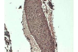 Immunohistochemistry (IHC) image for anti-Solute Carrier Family 5 (Sodium/iodide Cotransporter), Member 5 (SLC5A5) (AA 468-643) antibody (PerCP) (ABIN2484461)