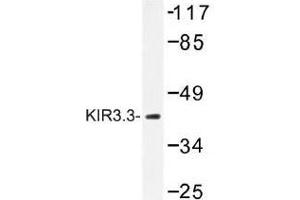 Image no. 1 for anti-Potassium Inwardly-Rectifying Channel, Subfamily J, Member 9 (KCNJ9) antibody (ABIN317838) (KCNJ9 抗体)