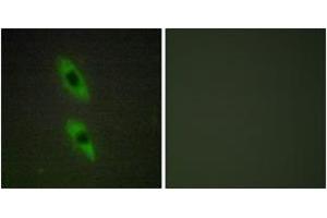 Immunofluorescence analysis of HuvEc cells, using FADD Antibody. (FADD 抗体  (AA 101-150))