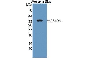 Detection of Recombinant ST2, Human using Polyclonal Antibody to Syntenin 2 (ST2) (SDCBP2 抗体  (AA 1-292))