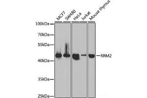 Western blot analysis of extracts of various cell lines using RRM2 Polyclonal Antibody at dilution of 1:1000. (RRM2 抗体)