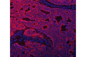 IF analysis of TFEB using anti-TFEB antibody (ABIN7600648). (TFEB 抗体  (AA 214-326))