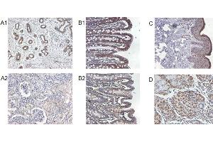 Immunohistochemical staining of IL-37 in human kidney (A1), human colon (B1), human skin (C) and human stomach (D) using anti-IL-37 . (IL-37 抗体)